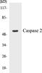 Caspase 2 antibody, EKC1085, Boster Biological Technology, Western Blot image 