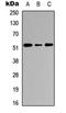 Activation Induced Cytidine Deaminase antibody, orb234755, Biorbyt, Western Blot image 