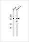 Glucoside Xylosyltransferase 2 antibody, 60-617, ProSci, Western Blot image 