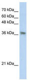 Phytanoyl-CoA 2-Hydroxylase Interacting Protein antibody, TA334677, Origene, Western Blot image 
