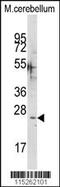 Calcium Binding Protein 1 antibody, MBS9209954, MyBioSource, Western Blot image 