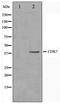 Cyclin Dependent Kinase 7 antibody, TA347484, Origene, Western Blot image 