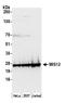 MIS12 Kinetochore Complex Component antibody, A300-776A, Bethyl Labs, Western Blot image 
