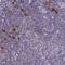 Sorting Nexin 11 antibody, HPA054660, Atlas Antibodies, Immunohistochemistry paraffin image 