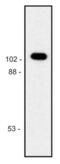 Galactosidase Beta 1 antibody, LS-C45884, Lifespan Biosciences, Western Blot image 
