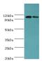 Aldehyde Dehydrogenase 1 Family Member L1 antibody, MBS1497777, MyBioSource, Western Blot image 