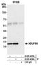 NADH dehydrogenase [ubiquinone] 1 beta subcomplex subunit 6 antibody, A305-435A, Bethyl Labs, Immunoprecipitation image 