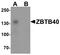 Zinc Finger And BTB Domain Containing 40 antibody, LS-B8836, Lifespan Biosciences, Western Blot image 