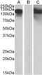 Cadherin 11 antibody, PA5-19318, Invitrogen Antibodies, Western Blot image 