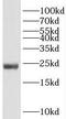 Ribosomal Protein S5 antibody, FNab07481, FineTest, Western Blot image 