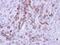 MX Dynamin Like GTPase 1 antibody, PA5-22101, Invitrogen Antibodies, Immunohistochemistry paraffin image 