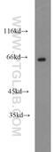 Leiomodin 3 antibody, 14948-1-AP, Proteintech Group, Western Blot image 