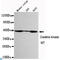 Creatine Kinase, Mitochondrial 1B antibody, LS-C812923, Lifespan Biosciences, Western Blot image 