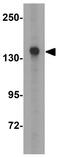 Jhdm2a antibody, GTX85253, GeneTex, Western Blot image 