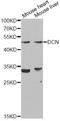 Decorin antibody, A1669, ABclonal Technology, Western Blot image 