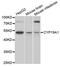 Cytochrome P450 Family 19 Subfamily A Member 1 antibody, MBS127536, MyBioSource, Western Blot image 