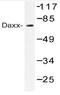 Death Domain Associated Protein antibody, AP20484PU-N, Origene, Western Blot image 