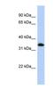 Zinc Finger Protein 511 antibody, NBP1-80279, Novus Biologicals, Western Blot image 