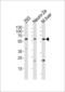CCD36 antibody, LS-C168415, Lifespan Biosciences, Western Blot image 