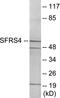Serine And Arginine Rich Splicing Factor 4 antibody, EKC1780, Boster Biological Technology, Western Blot image 