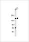 Integrin Subunit Alpha 2 antibody, GTX80593, GeneTex, Western Blot image 