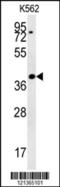 Protein DGCR14 antibody, 57-364, ProSci, Western Blot image 