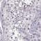 Alcohol Dehydrogenase 6 (Class V) antibody, NBP2-62661, Novus Biologicals, Immunohistochemistry paraffin image 