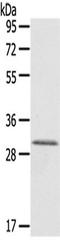 HIV-1 Tat Interactive Protein 2 antibody, TA350508, Origene, Western Blot image 