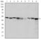 Chaperonin Containing TCP1 Subunit 2 antibody, GTX60497, GeneTex, Western Blot image 
