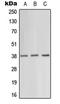 Protein Kinase AMP-Activated Non-Catalytic Subunit Gamma 1 antibody, LS-C352705, Lifespan Biosciences, Western Blot image 