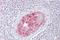 Src Like Adaptor antibody, A00418, Boster Biological Technology, Immunohistochemistry paraffin image 