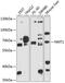 N-Myristoyltransferase 1 antibody, 23-709, ProSci, Western Blot image 