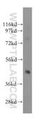 Adenosine Kinase antibody, 15477-1-AP, Proteintech Group, Western Blot image 