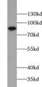 Zinc Finger Protein 184 antibody, FNab09663, FineTest, Western Blot image 