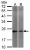 Neuronal Calcium Sensor 1 antibody, LS-C185710, Lifespan Biosciences, Western Blot image 