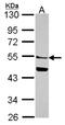 Mannosyl (Alpha-1,6-)-Glycoprotein Beta-1,2-N-Acetylglucosaminyltransferase antibody, NBP2-17284, Novus Biologicals, Western Blot image 