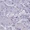 Single-Pass Membrane Protein With Coiled-Coil Domains 1 antibody, HPA061937, Atlas Antibodies, Immunohistochemistry frozen image 