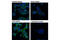 Acetyl-CoA Carboxylase Beta antibody, 11818S, Cell Signaling Technology, Immunocytochemistry image 