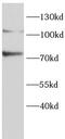 Lipase E, Hormone Sensitive Type antibody, FNab10341, FineTest, Western Blot image 