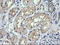 Retinoic Acid Receptor Responder 1 antibody, LS-C174673, Lifespan Biosciences, Immunohistochemistry paraffin image 