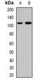 Dolichol-phosphate mannosyltransferase antibody, orb341344, Biorbyt, Western Blot image 