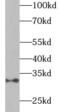 Adiponectin, C1Q And Collagen Domain Containing antibody, FNab09814, FineTest, Western Blot image 