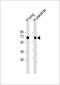 Solute Carrier Family 7 Member 5 antibody, M01016-1, Boster Biological Technology, Western Blot image 