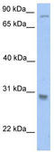 Glutathione S-transferase theta-1 antibody, TA346677, Origene, Western Blot image 