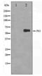 Tumor Protein P63 antibody, LS-C415929, Lifespan Biosciences, Western Blot image 