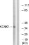 TWIK1 antibody, abx014723, Abbexa, Western Blot image 