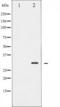 BCL2 antibody, TA325260, Origene, Western Blot image 
