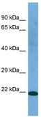 Cilia And Flagella Associated Protein 410 antibody, TA338923, Origene, Western Blot image 