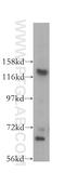 Nucleolar Protein 6 antibody, 16361-1-AP, Proteintech Group, Western Blot image 
