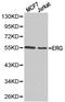 ETS Transcription Factor ERG antibody, LS-C192502, Lifespan Biosciences, Western Blot image 